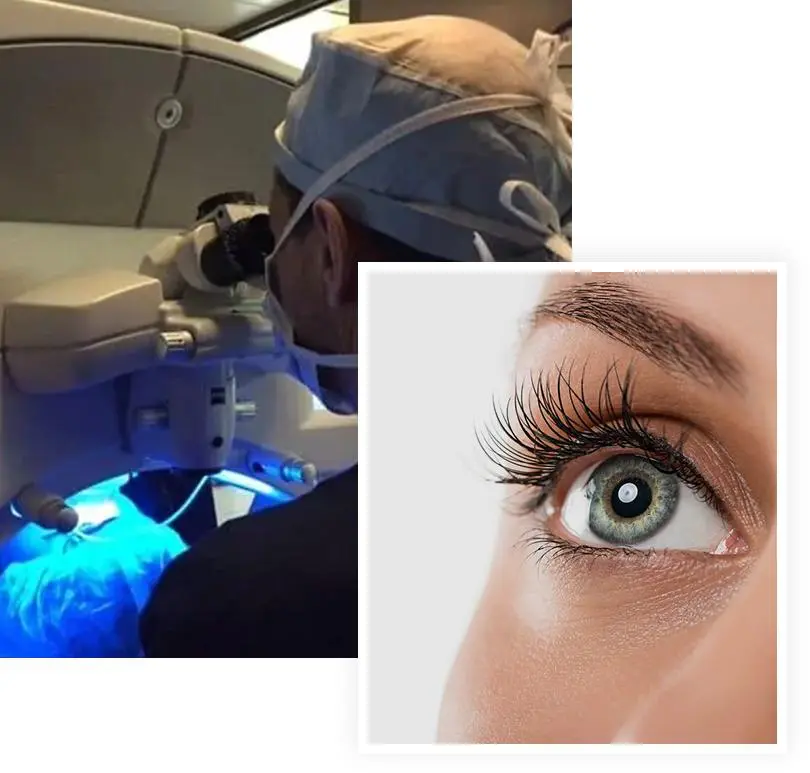 A person with long eyelashes and an eye surgery.
