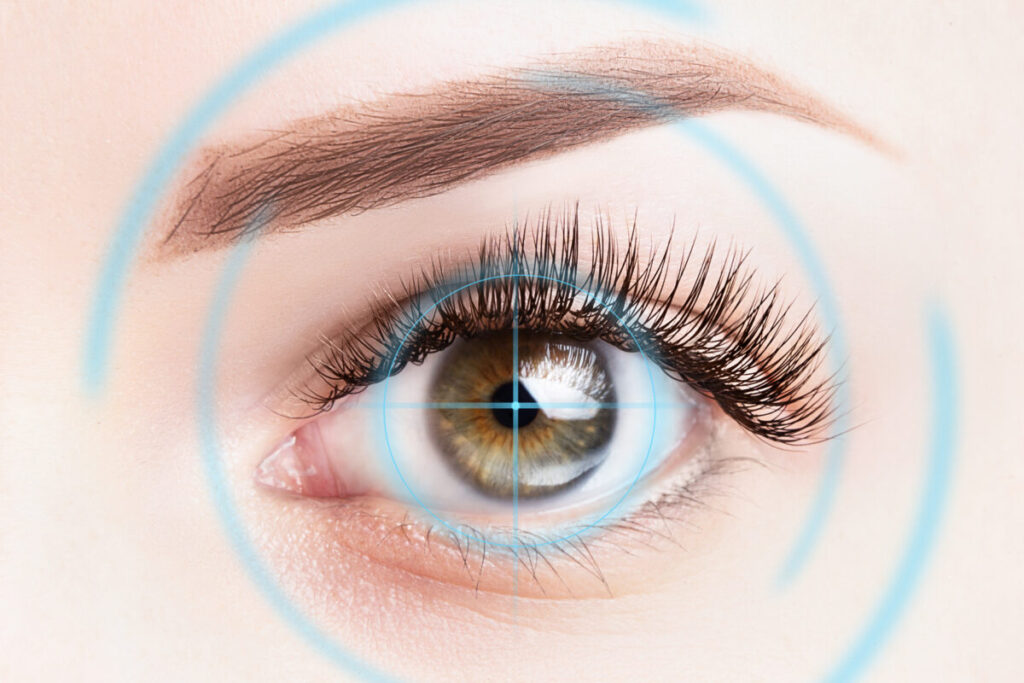 Eye with Mapping Tracker for PRK Surgery