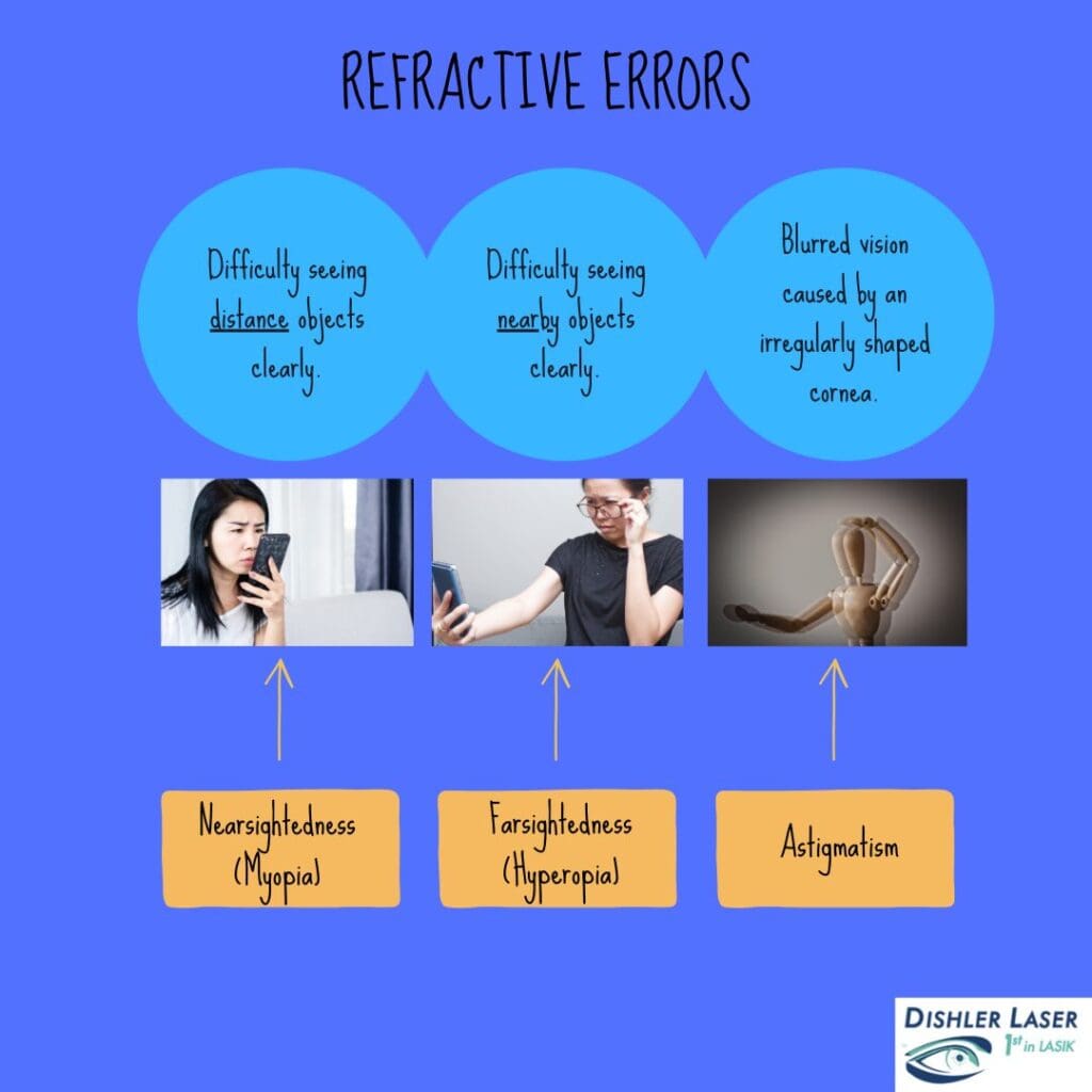 LASIK Refractive Errors